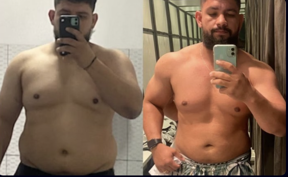 Registro de evolução 2: comparação de antes e depois