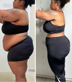 Registro de evolução 3: comparação de antes e depois