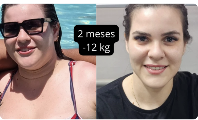 Registro de evolução 4: comparação de antes e depois